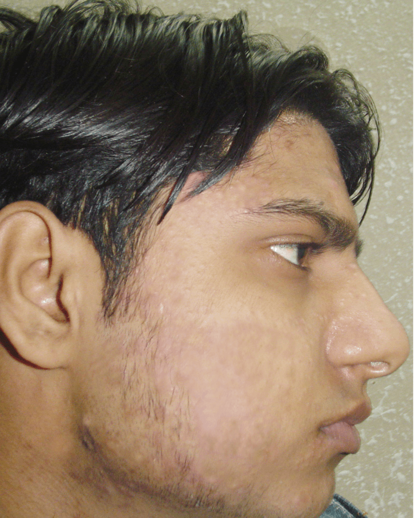 After Treatment Image 1