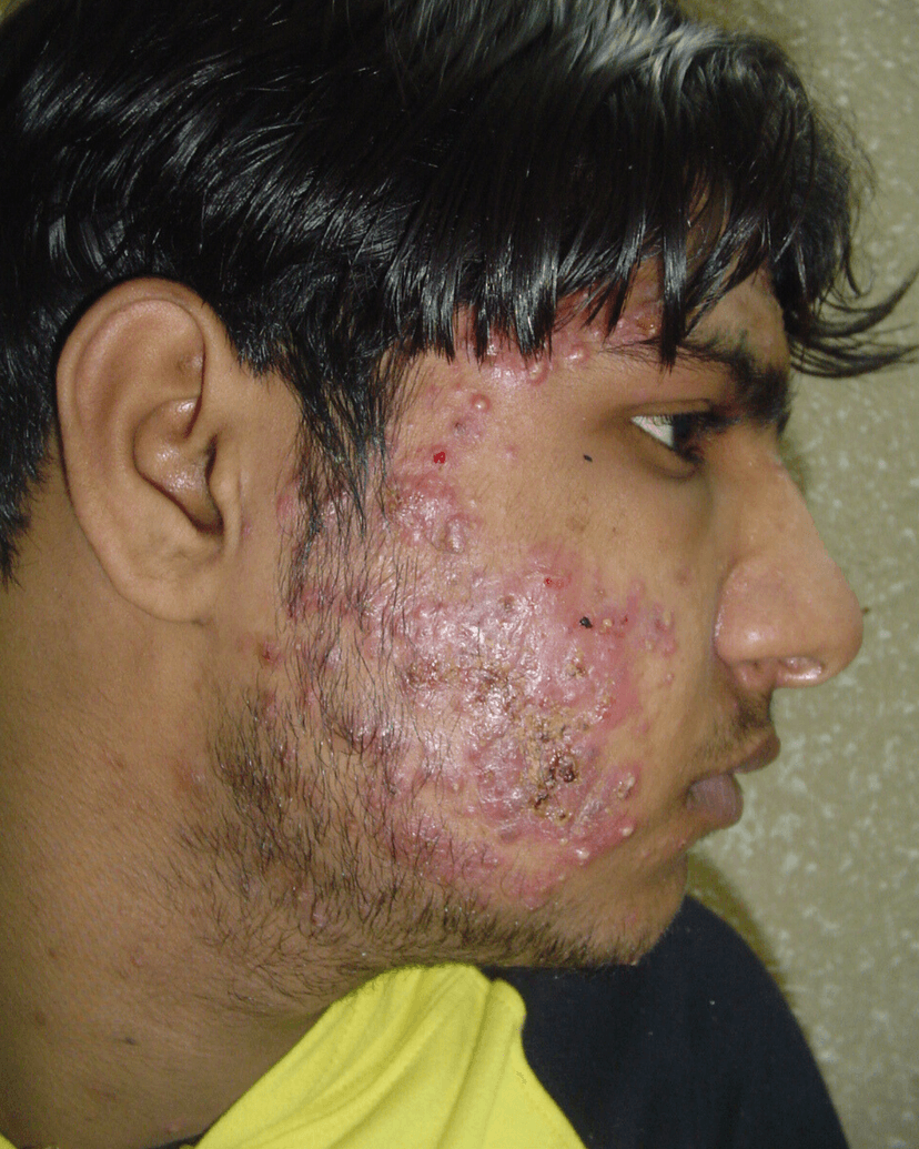 Before Treatment Image 1